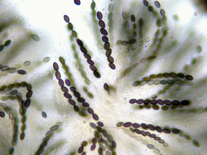 Coniochaeta pulveracea 12 - Ascos x 400-001